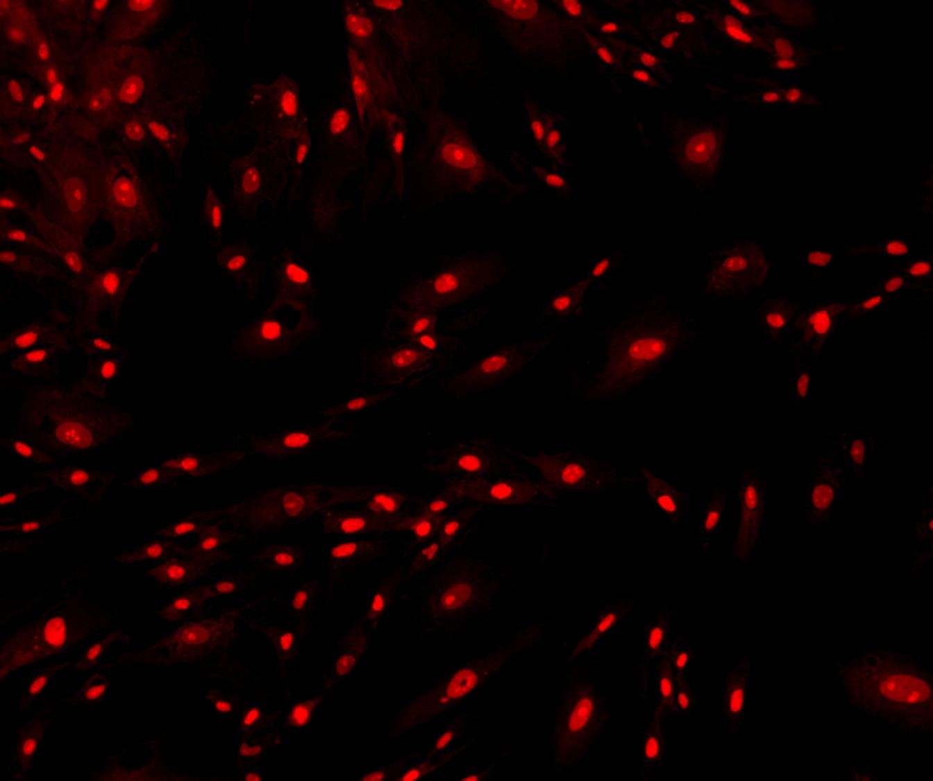 Nonviable human fibroblasts stained with Cytus™ Red.