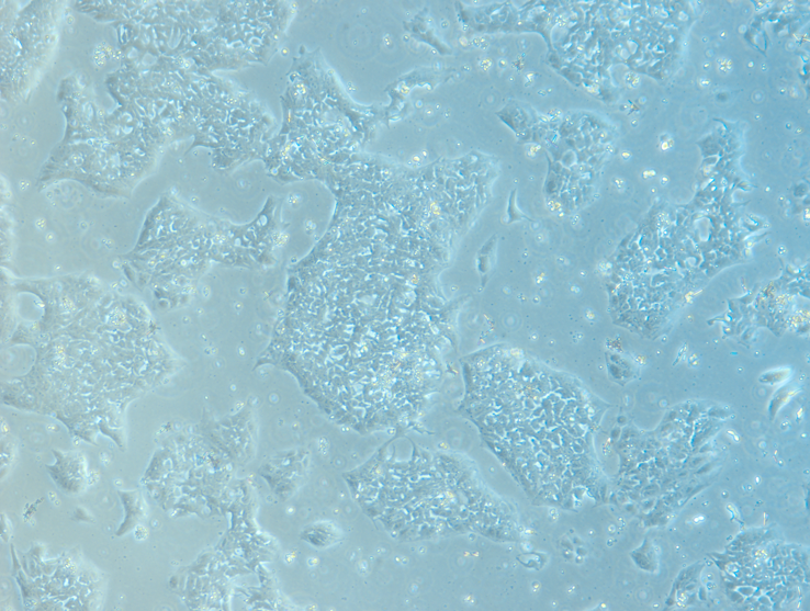 iPS Cell Line ASE-9250 72 hours after thawing.