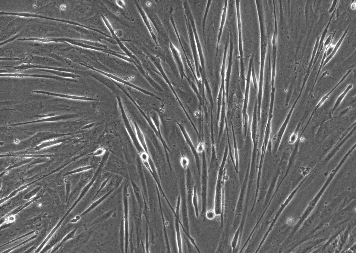iPSC-derived Myoblasts with Media