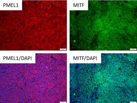 iPSC-derived Retinal Pigment Epithelium (RPE) Cells with Media