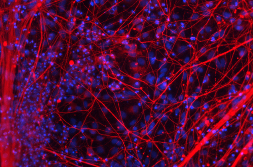 iPSC-derived Cortical Neurons with Media