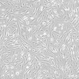 Neo-resistant MEF, P2, untreated