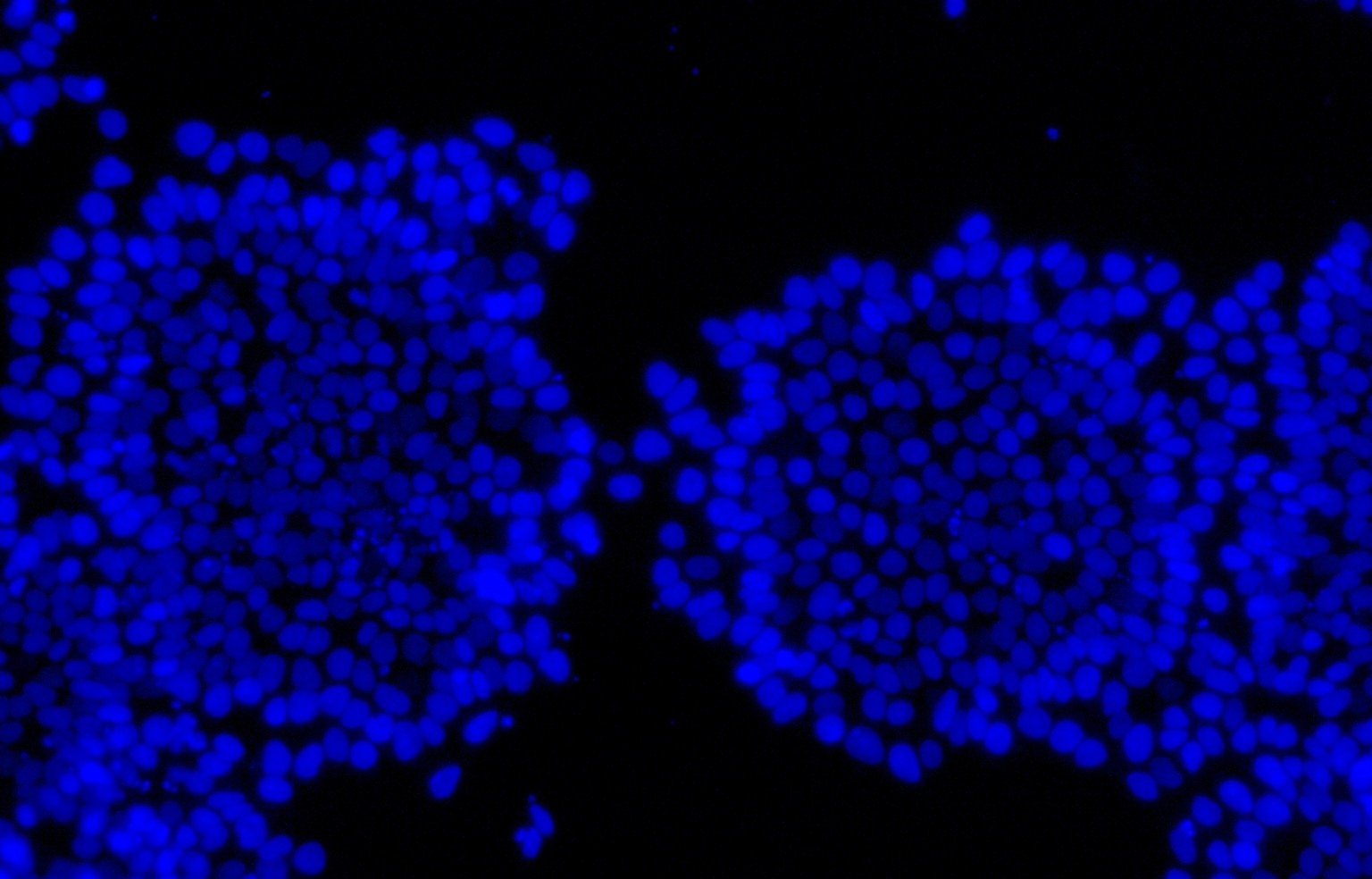 SSEA4 DAPI Staining of Exosomes (20x)