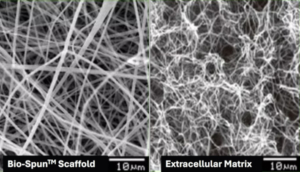 Comparison of an microscopic picuture of Bio-Spun scaffold material with body's natural scaffold.