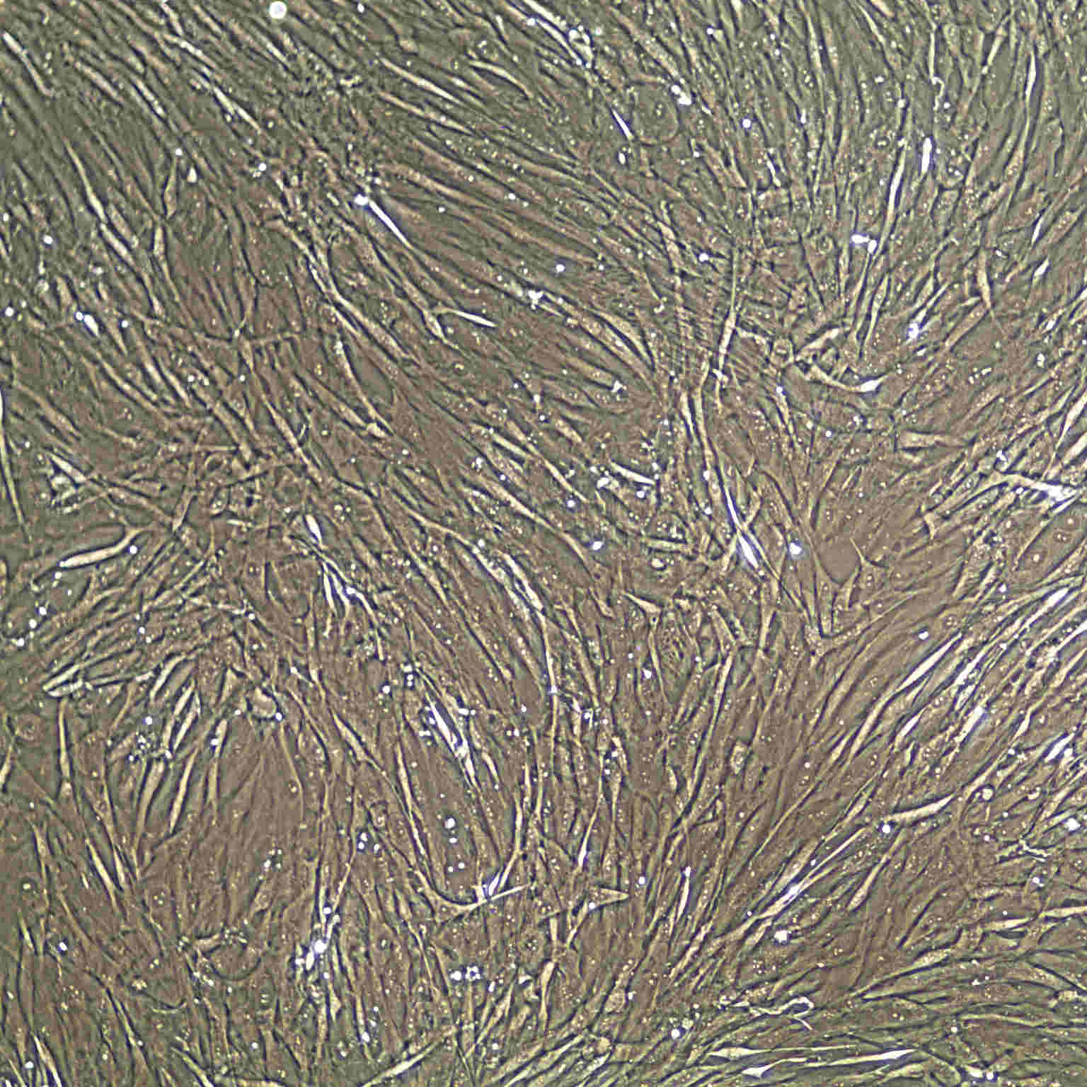 Human Bladder Smooth Muscle Cells