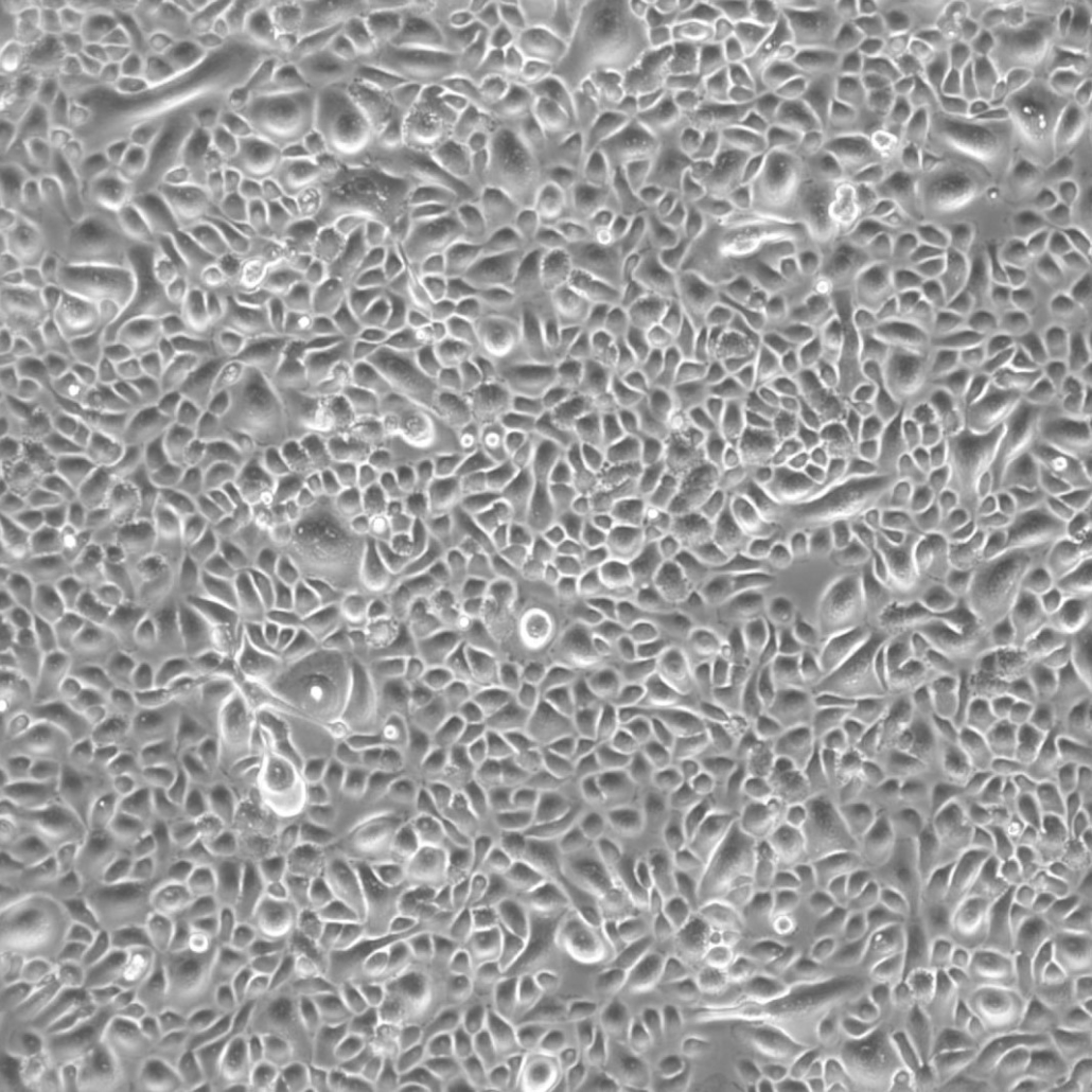 lobar-bronchial-epithelial-cells-secondary-cellsystems